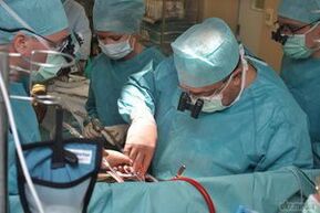 kirurško zdravljenje krčnih žil medenice