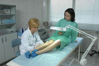 Laserska terapija za krčne žile na nogah
