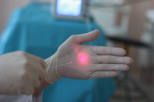 kako se pripraviti na lasersko zdravljenje krčnih žil